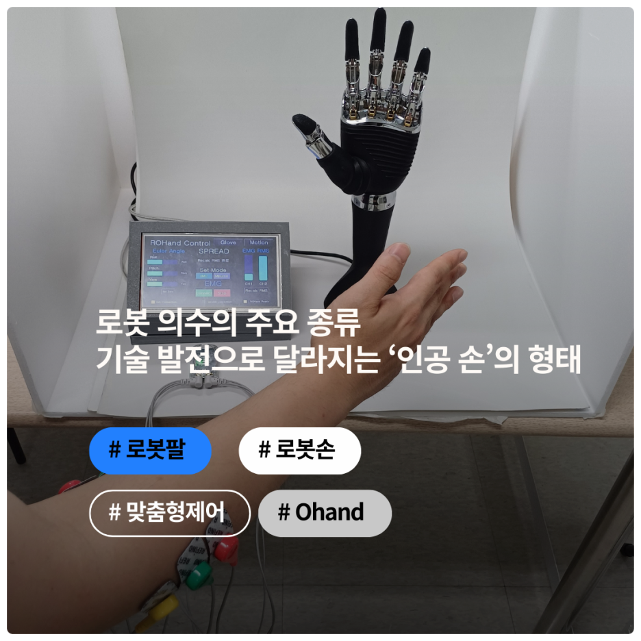 로봇 의수의 주요 종류 : 기술 발전으로 달라지는 ‘인공 손’의 형태