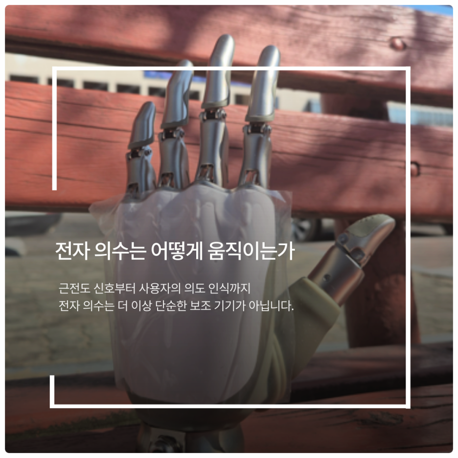 전자 의수는 어떻게 움직이는가